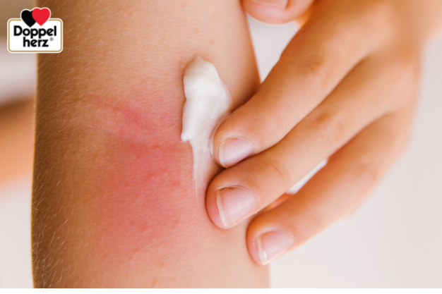 Nhóm da dễ bị dị ứng thì tốt nhất trước khi sử dụng sản phẩm gì nên thử ở một vùng nhỏ trên da trước