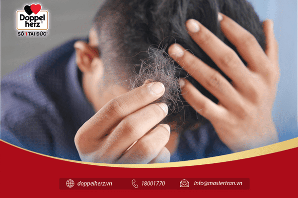 Di truyền là một trong những nguyên nhân rụng tóc ở nam phổ biến