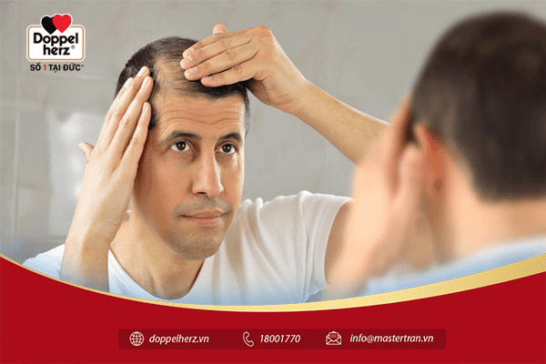 Di truyền là một trong những nguyên nhân gây rụng tóc ở nam phổ biến