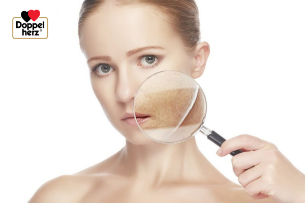 Tế bào gốc trị nám là gì? Tế bào gốc có hiệu quả không?