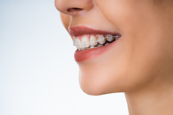 Cách phòng ngừa khớp cắn ngược