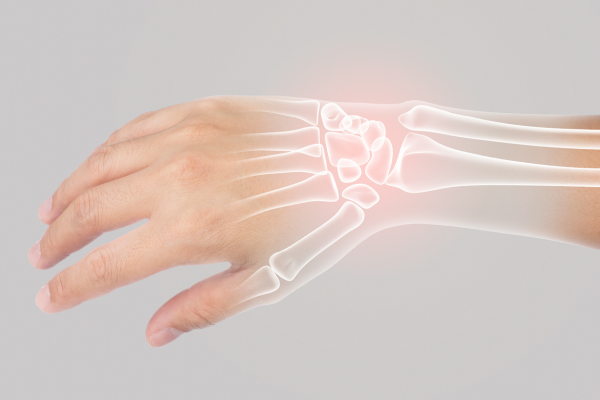 Canxi là gì_ Vì sao canxi lại quan trọng đến vậy