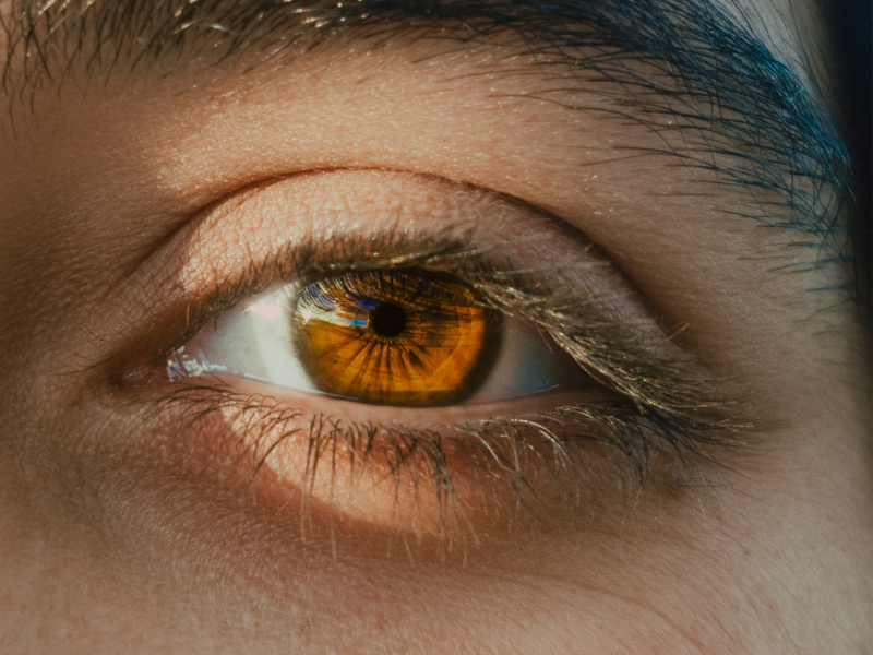 Tắc lệ đạo là nguyên nhân chủ yếu gây ra chảy nước mắt