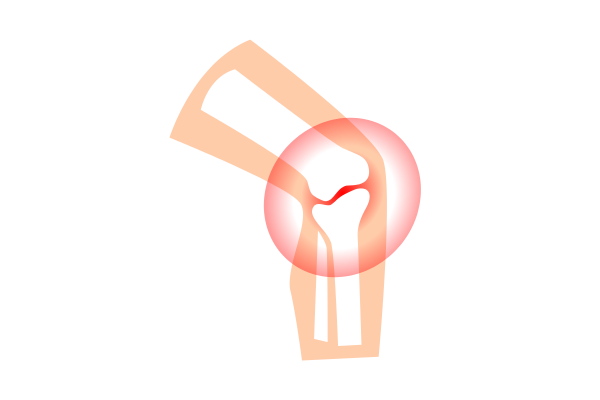 Vậy mất sụn khớp rồi có tái tạo lại được không