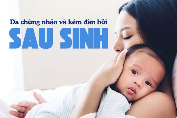 da đàn hồi kém sau khi sinh