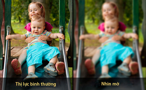 Nguyên nhân bị bệnh cườm khô là gì?